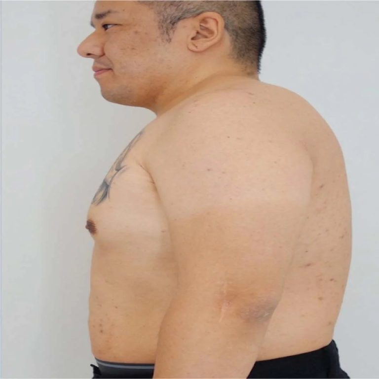 Understanding Side Effects of Weight Loss Tablets and Safe Use